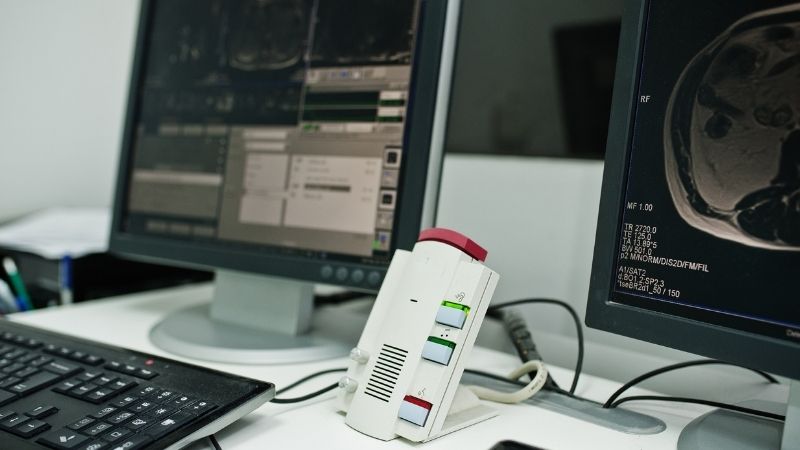 Memahami Masa Kitaran PLC: Optimumkan Automasi Anda 12 masa kitaran PLC